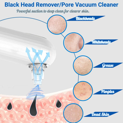 Avilana Blackhead Remover Pore Vacuum Kit - Mini Electric Suction Pore Extractor Vacuum Blackhead Remover